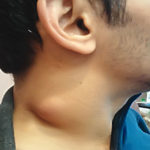 neck