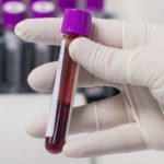 blood test colon cancer,FG to promote safe blood use in hospital ― Ehanire, know your blood type