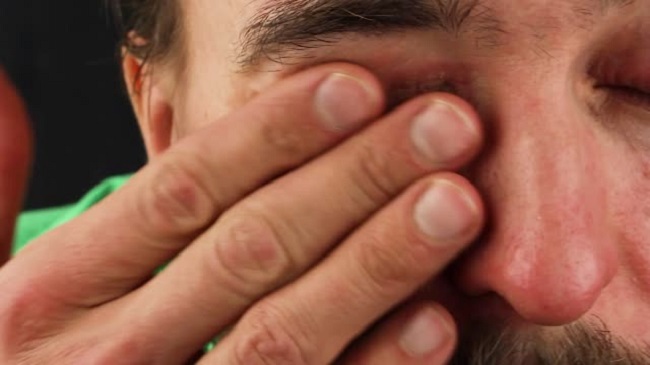 How to deal with itchy eyes - The Economic Times