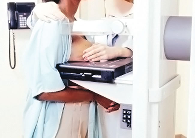 Breast