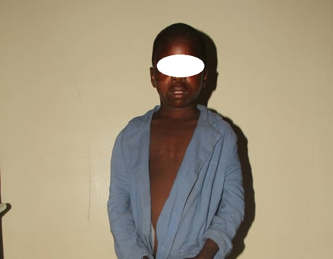 How suspected ritualists removed eye of 12-year-old boy in Bauchi ― Police