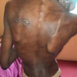 Police rescue malnourished 17-year-old
