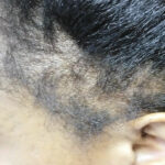 hair