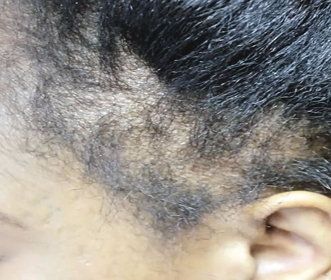 hair