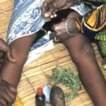 FGM