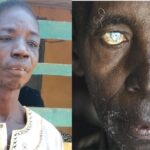 river blindness treatment states,
