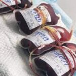 blood transfusion
