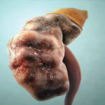 Kidney