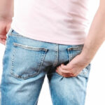Itching in my anus