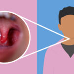 Sore throat