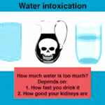 water intoxication