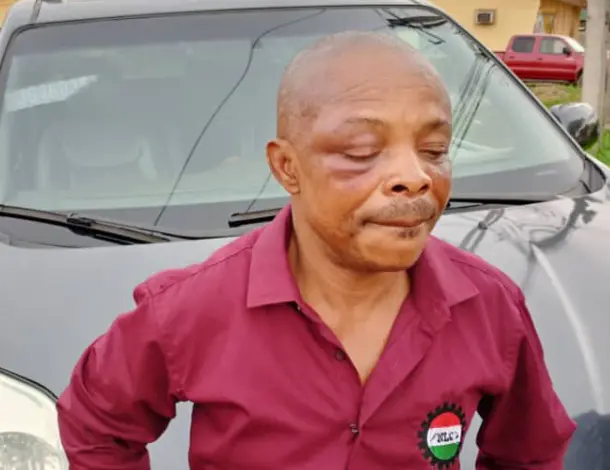 NLC president narrates ordeal