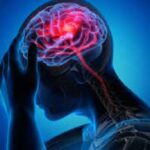 stroke cases
