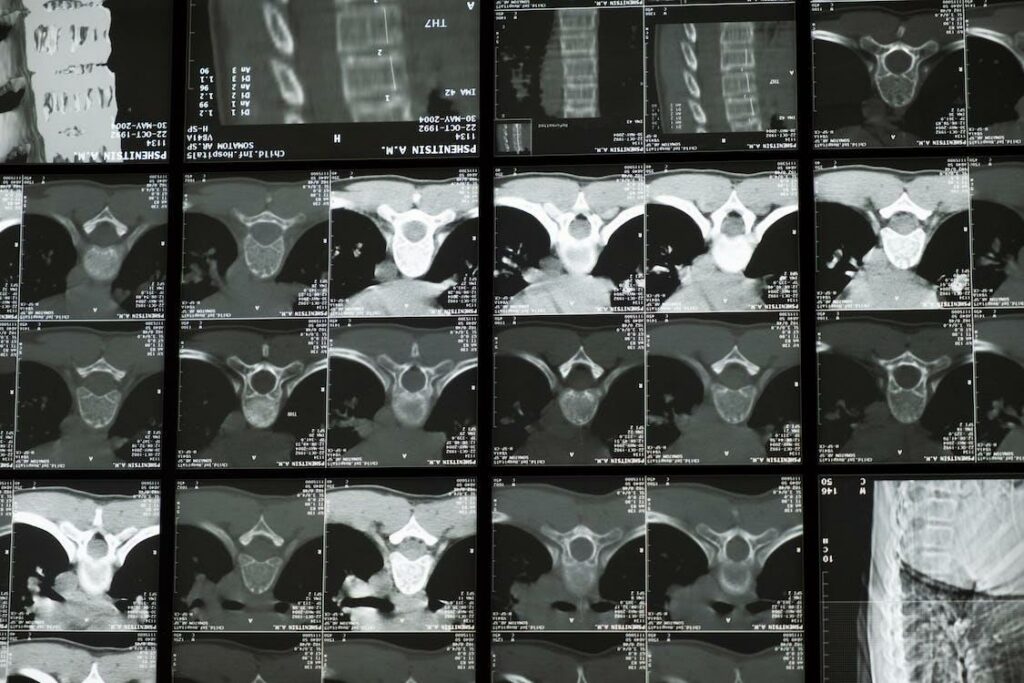 Medical Imaging