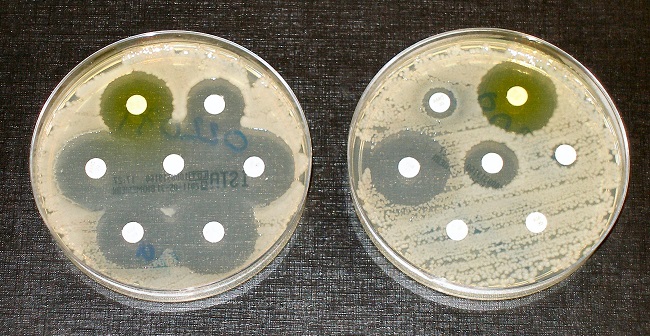 new antibiotic-resistant bacteria