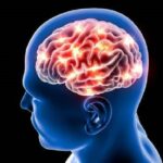 neurological