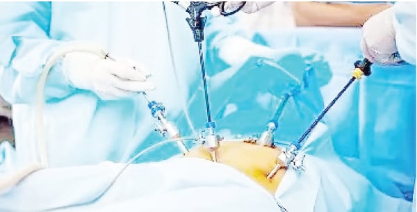 Is prostate surgery necessary