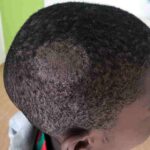 Ringworm keeps attacking your child