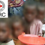 malnourished children