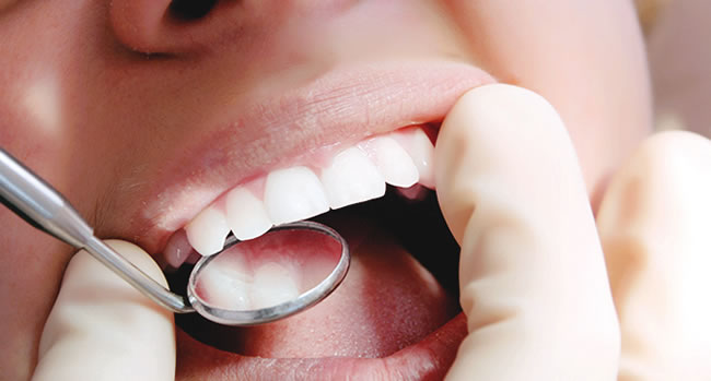 Keeping my teeth at 70