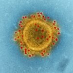 Diseases
