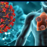 Human Metapneumovirus outbreak