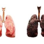 non-smokers can get lung cancer