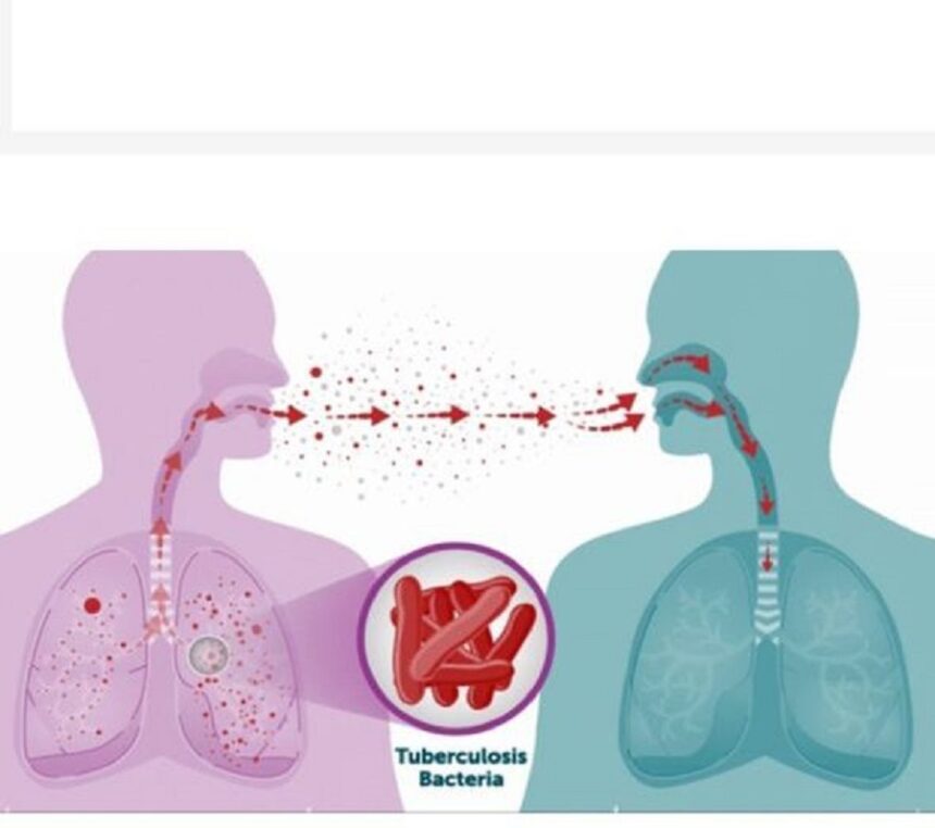 Tuberculosis awareness campaign