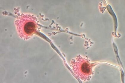 Fungi can eat you