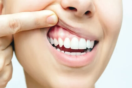 Gum infection