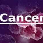 Nigeria needs robust cancer