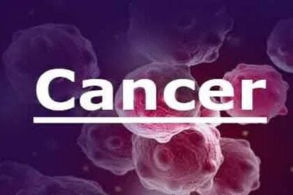 Nigeria needs robust cancer