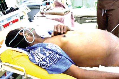 Nigeria’s hepatitis