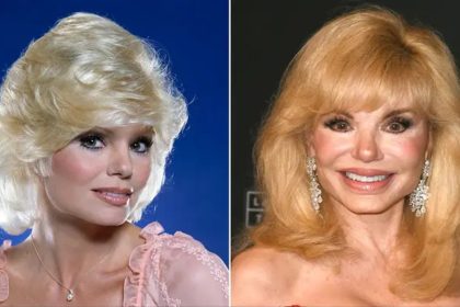 Loni Anderson