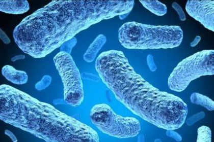 Legionnaires disease
