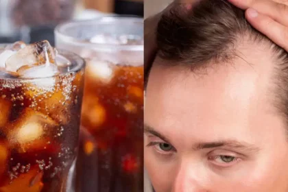 sugary drink lined to hair loss,