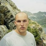 Receding Hairline