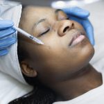 person-getting-micro-needling-beauty-treatment