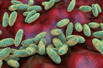 Pneumonic plague