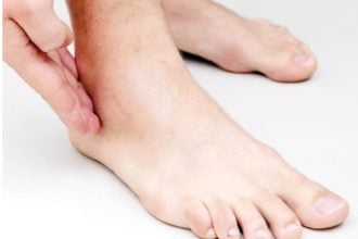 swollen ankles
