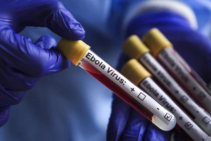 ebola