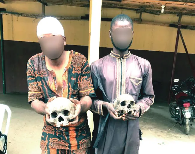 My quest for wealth landed me in another trouble after initial arrest, arraignment —Suspect caught with human skulls
