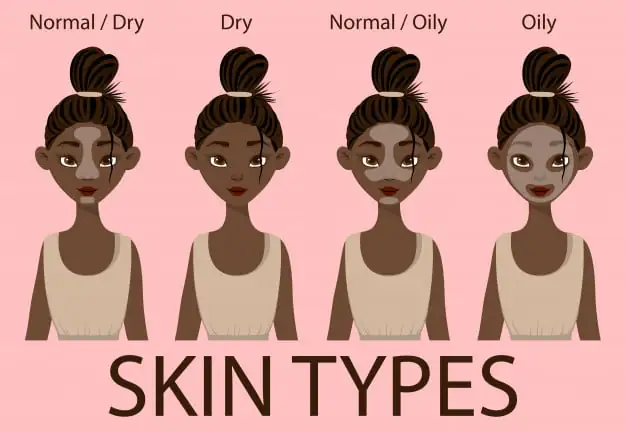 skin types