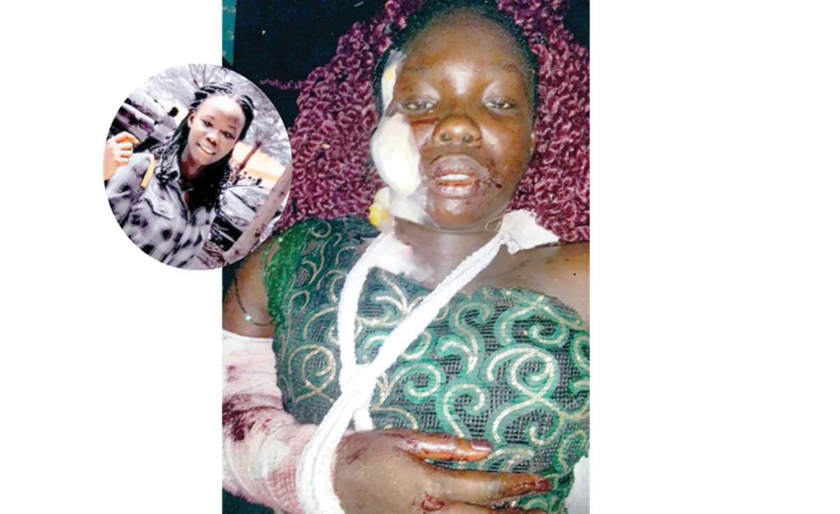 After surviving crash involving Dangote trailer, Precious wants to live again